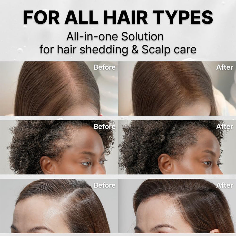 Nurtured Roots Hair Growth Serum — With Built-In Scalp Brush