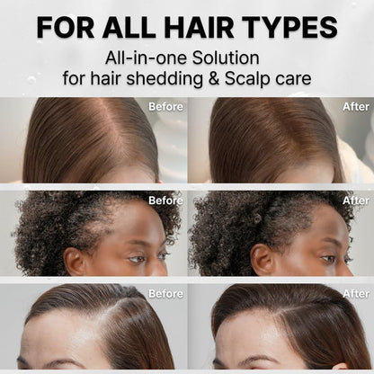 Nurtured Roots Hair Growth Serum — With Built-In Scalp Brush