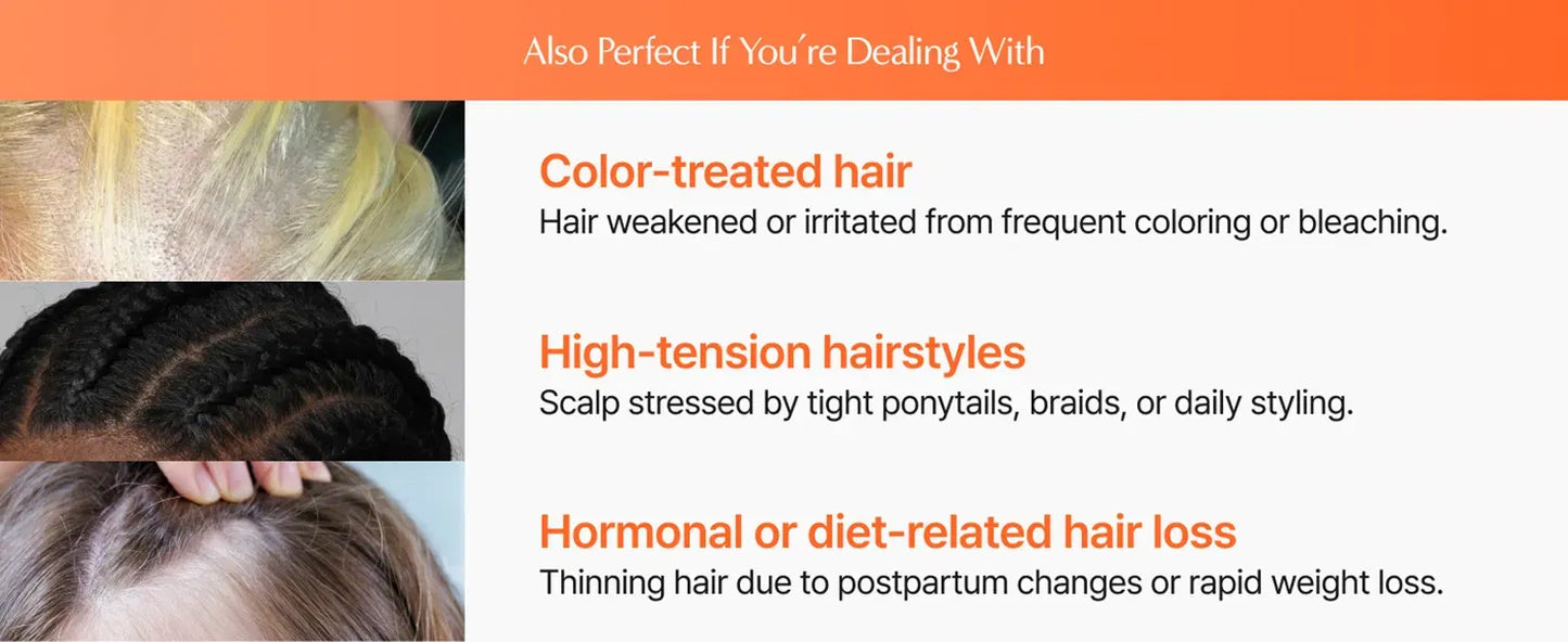 Nurtured Roots Hair Growth Serum — With Built-In Scalp Brush