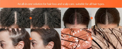 Nurtured Roots Hair Growth Serum — With Built-In Scalp Brush